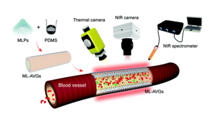 MaoPhageGroup's tweet photo. Our study @MaterHoriz showed #ArtificialVascularGrafts can monitor #Cardiovascular (CVD) severity with force-sensing material that emits NIR light to detect & manage vascular occlusion & hypertension
#InnovativeMedicalResearch #NIRSpectroscopy #Biomarkers
https://t.co/3LImUAjqQW https://t.co/UqQ0Np42WX