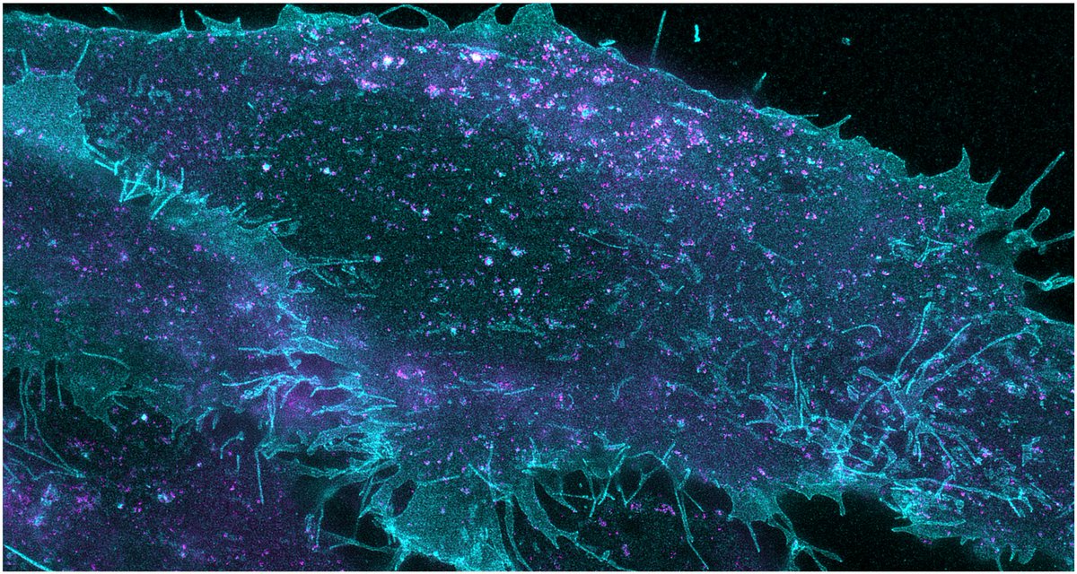 Here’s the big one: In collaboration with @Honigmann_Lab, @LabShevchenko, Björn Drobot and Martin Hof we present a general workflow for imaging the localization and transport of individual lipids in cells and mapping their metabolism.
biorxiv.org/content/10.110…