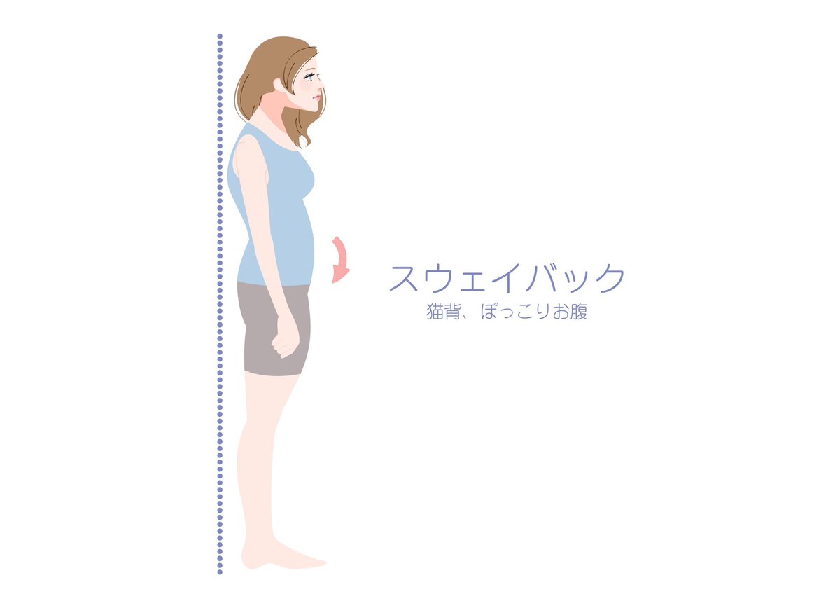 現代人に多い「スウェイバック」という姿勢！このタイプの方は反り腰と猫背を併発しやすい。

腸腰筋という姿勢を保持するための筋肉の働きが弱く、「ぽっこりお腹」や「下半身太り」、「猫背」などに繋がります。

なので改善するには腸腰筋を鍛えることが大切！スウェイバックさんはこれを参考に↓