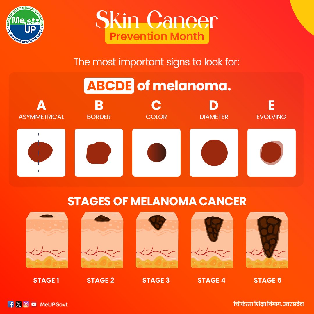 Shield your skin daily to prevent skin cancer. Regularly check your skin for any changes, and see a dermatologist if you find any suspicious spots. Early detection and removal of skin cancer can greatly improve the chances of successful treatment.

#MeUP #MedicalEducation