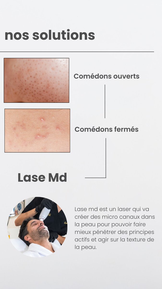 CCELYSEES's tweet photo. #LaseMd pour les pores dilatés et les irrégularités de la peau https://t.co/88S3DFwE2w