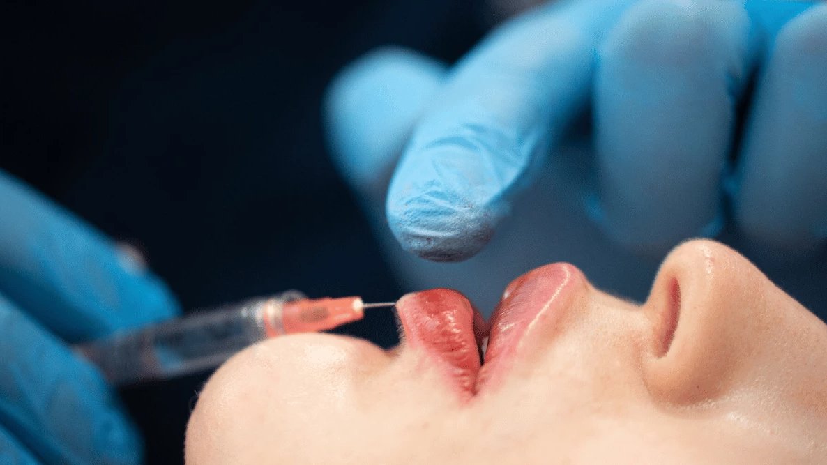 Dans un contexte où la médecine esthétique connaît une popularité croissante, une récente enquête du journal Libération met en lumière les failles réglementaires qui permettent des dérives potentiellement dangereuses. On vous explique.

crpce.com/actualites/enq… #medecineesthetique