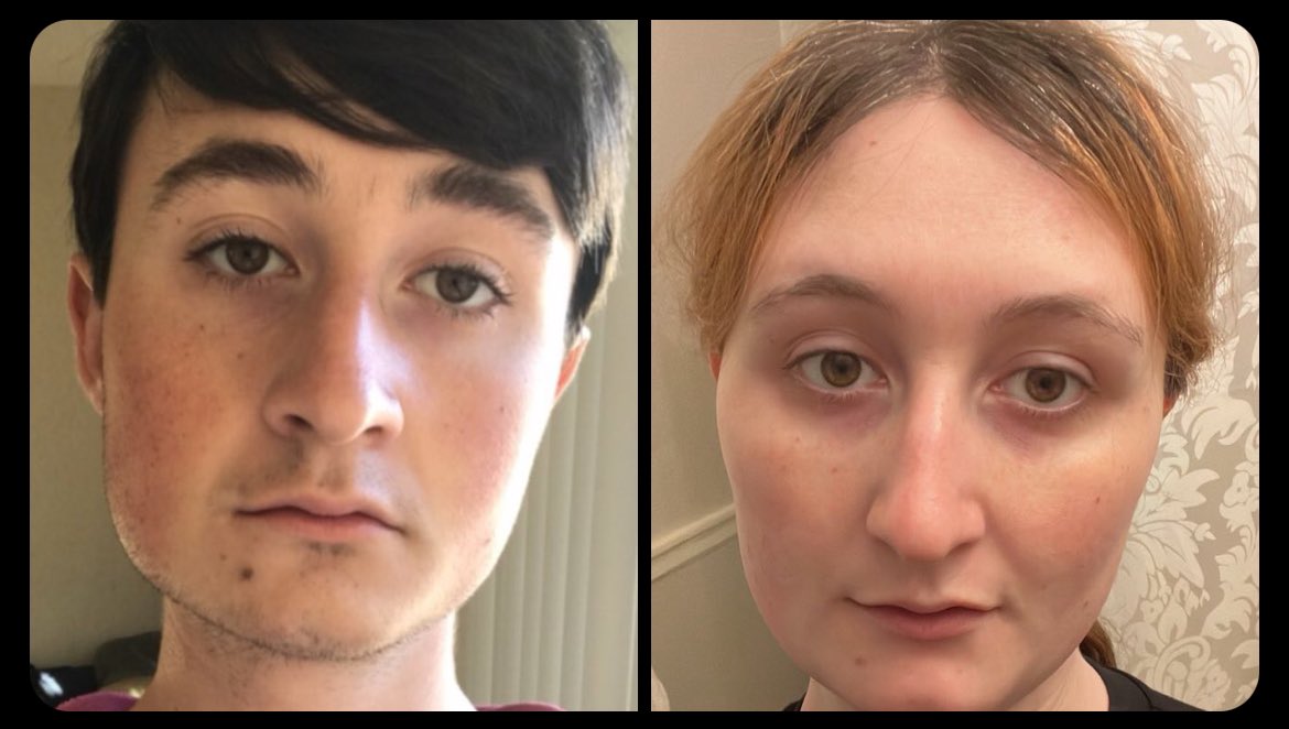 For all the TERFs and bigots who say that HRT doesn’t do anything, look how much it changed my face shape. Estrogen got rid of my square jaw and gave me cheekbones.