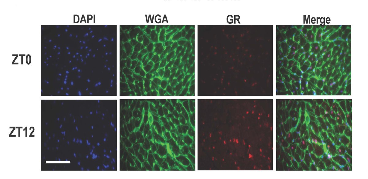 Tikhomirov & colleagues found that blocking #GR signaling abrogated ion channel rhythms & subsequently morning #VA. Learn about a potential new chronotherapeutic strategy to suppress VA occurrence at ahajrnls.org/3yo7p62