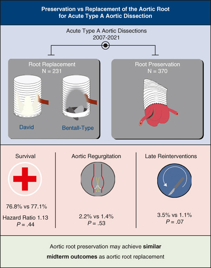 Aortic root preservation and aortic root replacement may achieve comparable midterm outcomes after repair of acute Type A #AorticDissection 🔗: jtcvs.org/article/S0022-… @IbrahimSultanMD @EdgarArandaMic1 @DSGMD @HviUpmc @AATSHQ #JTCVS #ATAAD #ARR #AorticRoot #Aorta