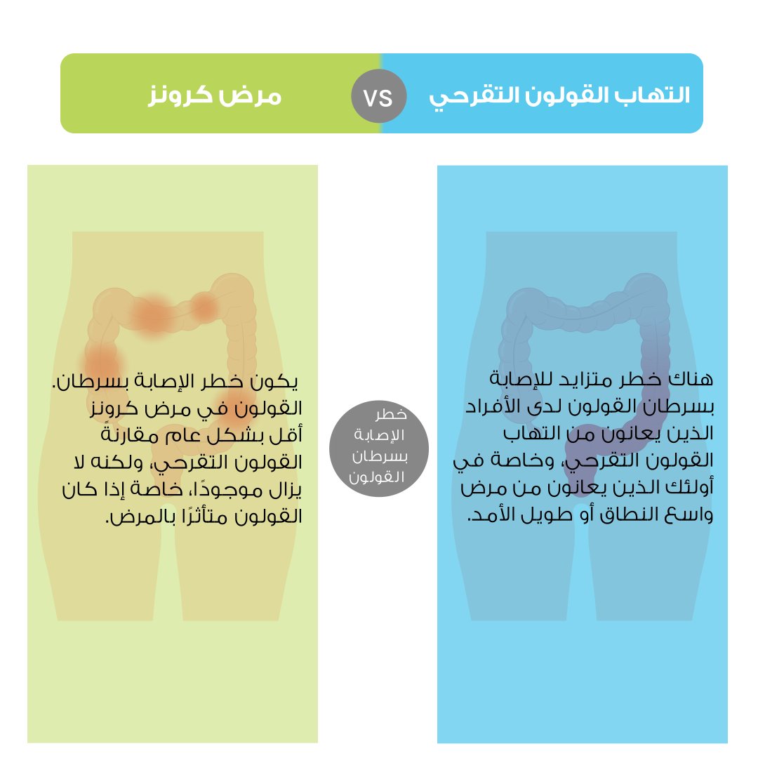 التهاب القولون التقرحي ومرض كرونز هما نوعان من أمراض التهاب المعوي التي كثيرًا ما يتم عدم التميز بينها .
دعنا نستكشف الاختلافات الرئيسية بينهما.

#UlcerativeColitis #CrohnsDisease #Crohns #ESCRS #UAE
