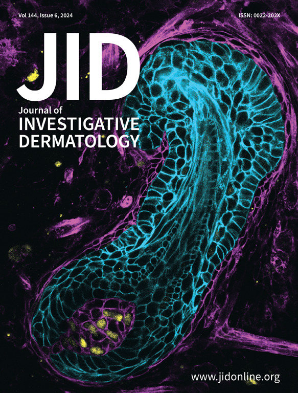 theJIDJournal's tweet photo. It’s here! The June issue of the @theJIDJournal is out now https://t.co/ca0zprQP66

Cover image:
Mammary Bud Epithelium Adopts Hair Follicle Cell Fate upon Contact with the Hair Follicle Dermal Condensate E13.5 mouse mammary bud epithelium expressing mGFP (cyan) was manually separated from the surrounding mammary mesenchyme after enzyme treatment, and recombined with the E16.5 back skin mesenchyme dissected from a mouse embryo
ubiquitously expressing mTdtomato (magenta). The recombinant was cultured for 6 days before fixation and whole-mount immunostaining with the dermal papilla marker Sox2 (yellow). Z-stack images were captured using Leica SP8 Upright confocal
microscope with an HC PL APO 20x/0.75 IMM CORR CS2 objective.
Image courtesy of Qiang Lan of Cell and Tissue Dynamics Research Program, Institute of Biotechnology, Helsinki Institute of Life Sciences (HiLIFE), University of Helsinki, Finland.

#dermatology #skinresearch #mammary #derm #dermatologist #dermresearch #dermscience