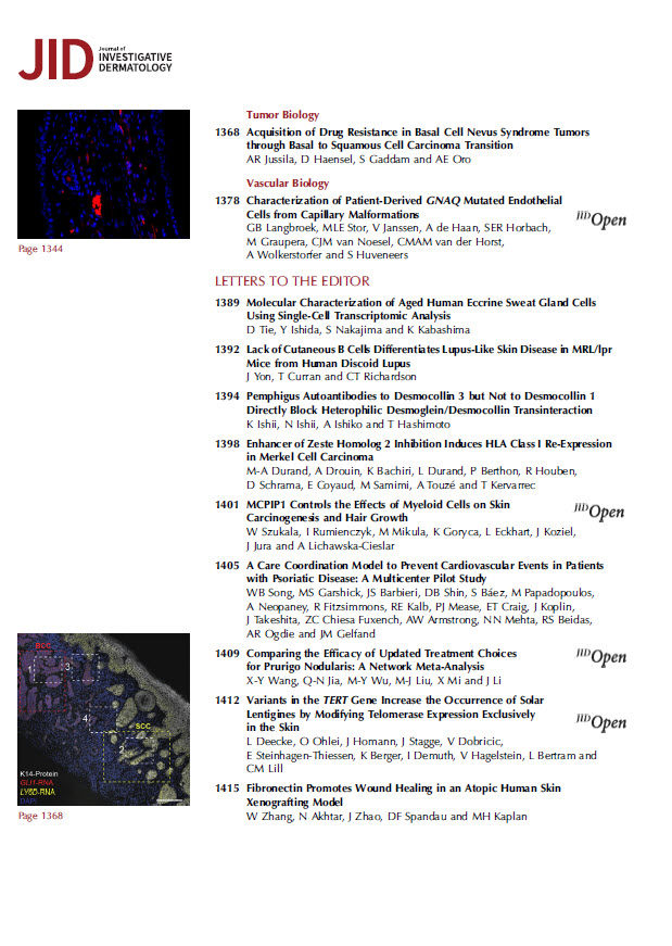 theJIDJournal's tweet photo. It’s here! The June issue of the @theJIDJournal is out now https://t.co/ca0zprQP66

Cover image:
Mammary Bud Epithelium Adopts Hair Follicle Cell Fate upon Contact with the Hair Follicle Dermal Condensate E13.5 mouse mammary bud epithelium expressing mGFP (cyan) was manually separated from the surrounding mammary mesenchyme after enzyme treatment, and recombined with the E16.5 back skin mesenchyme dissected from a mouse embryo
ubiquitously expressing mTdtomato (magenta). The recombinant was cultured for 6 days before fixation and whole-mount immunostaining with the dermal papilla marker Sox2 (yellow). Z-stack images were captured using Leica SP8 Upright confocal
microscope with an HC PL APO 20x/0.75 IMM CORR CS2 objective.
Image courtesy of Qiang Lan of Cell and Tissue Dynamics Research Program, Institute of Biotechnology, Helsinki Institute of Life Sciences (HiLIFE), University of Helsinki, Finland.

#dermatology #skinresearch #mammary #derm #dermatologist #dermresearch #dermscience