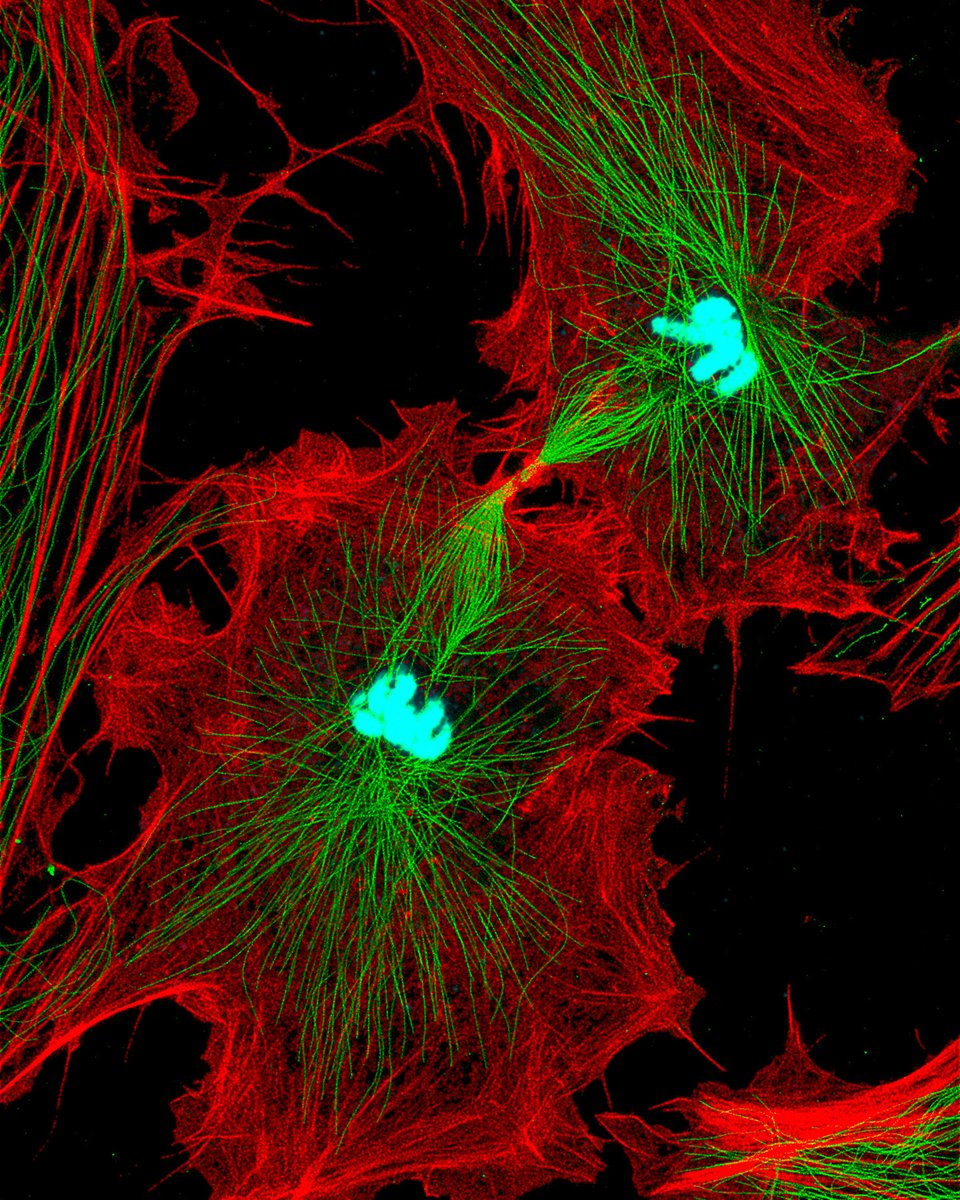 Stunning details of mitosis revealed by stimulated emission depletion (STED) microscopy. @microscopejock works to image cells + tissue in their intact environment for longer periods of time, and is part of a collaborative team hosting an intercontinental imaging workshop