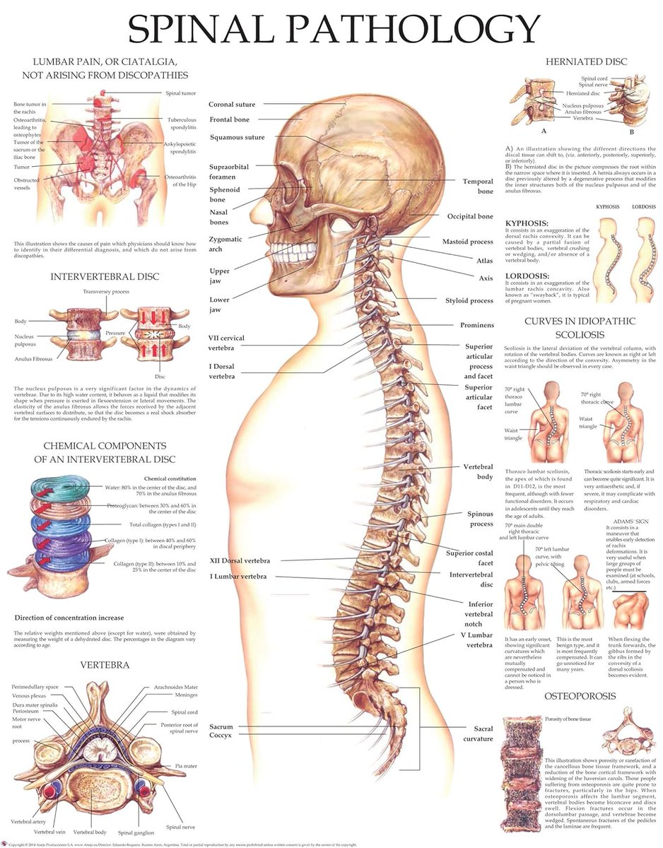 In this infographic, some causes of lumbar pain  which are NOT related to the discopathies mentioned.  Aside from that, a brief explanation of herniated disc, osteoporosis as well as kyphosis and Scoliosis mentioned.