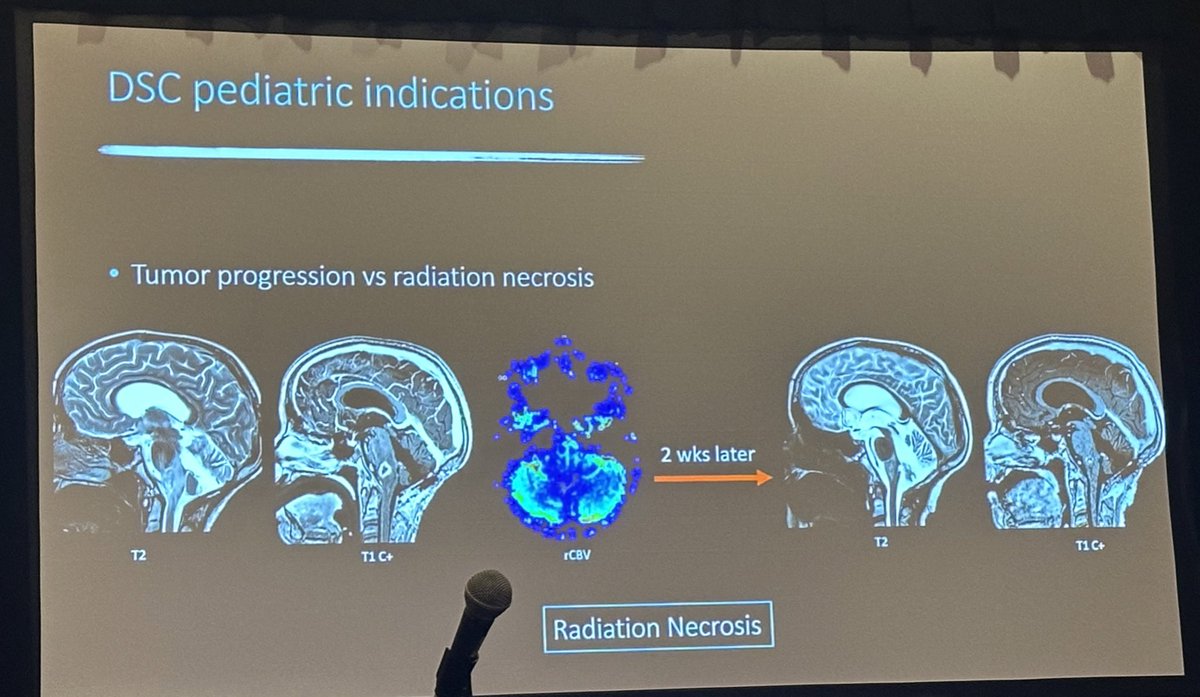 The one and only @SusanPalasis from @ChildrensATLRad @EmoryRadiology teaching us about Pediatric Brain Perfusion at #ASNR24! @TheASNR @The_ASPNR @theASFNR