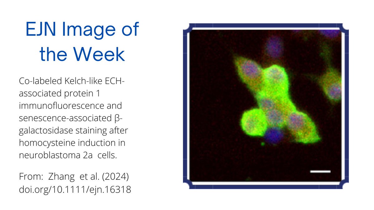 Check out the latest installment in our Image of the Week series! From: doi.org/10.1111/ejn.16… @FENSorg @WileyNeuro @HUST_China