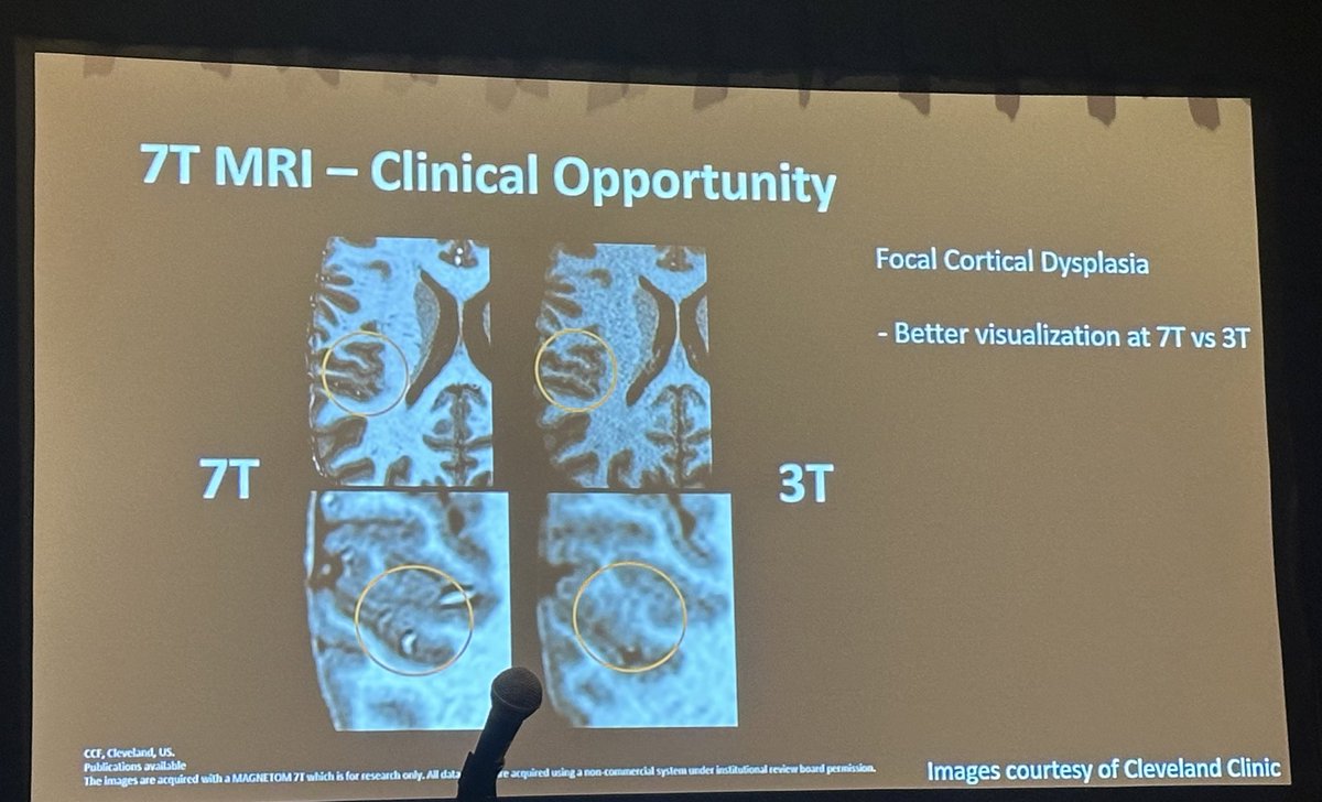 Award winning Dr. Tim Roberts from @CHOPRadiology discusses 7 Tesla in Pediatric Neuroimaging at #ASNR24! @TheASNR @The_ASPNR @PennRadiology