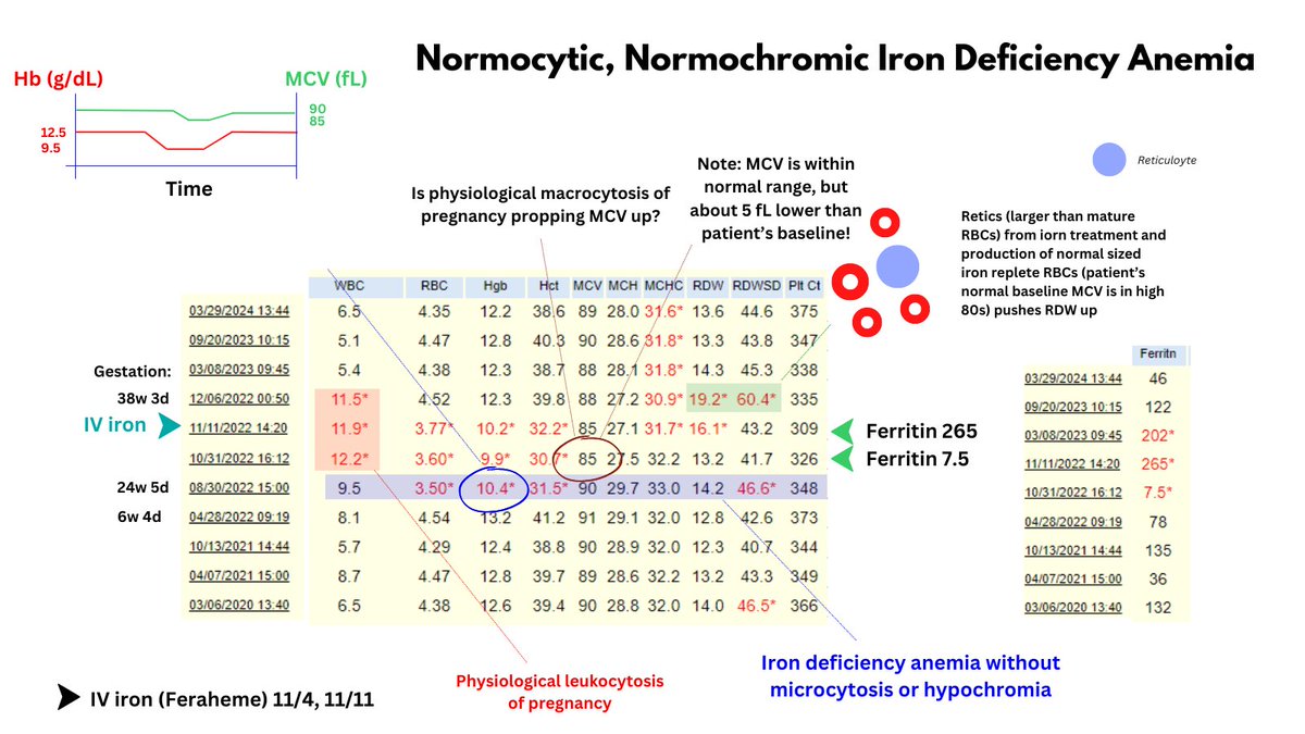 1/6 NORMOCYTIC, NORMOCHROMIC IRON DEFICIENCY ANEMIA (IDA) We tend to think of IDA as being microcytic (more consistently than hypochromic). However, there are certain situations in which the MCV is normal in IDA.