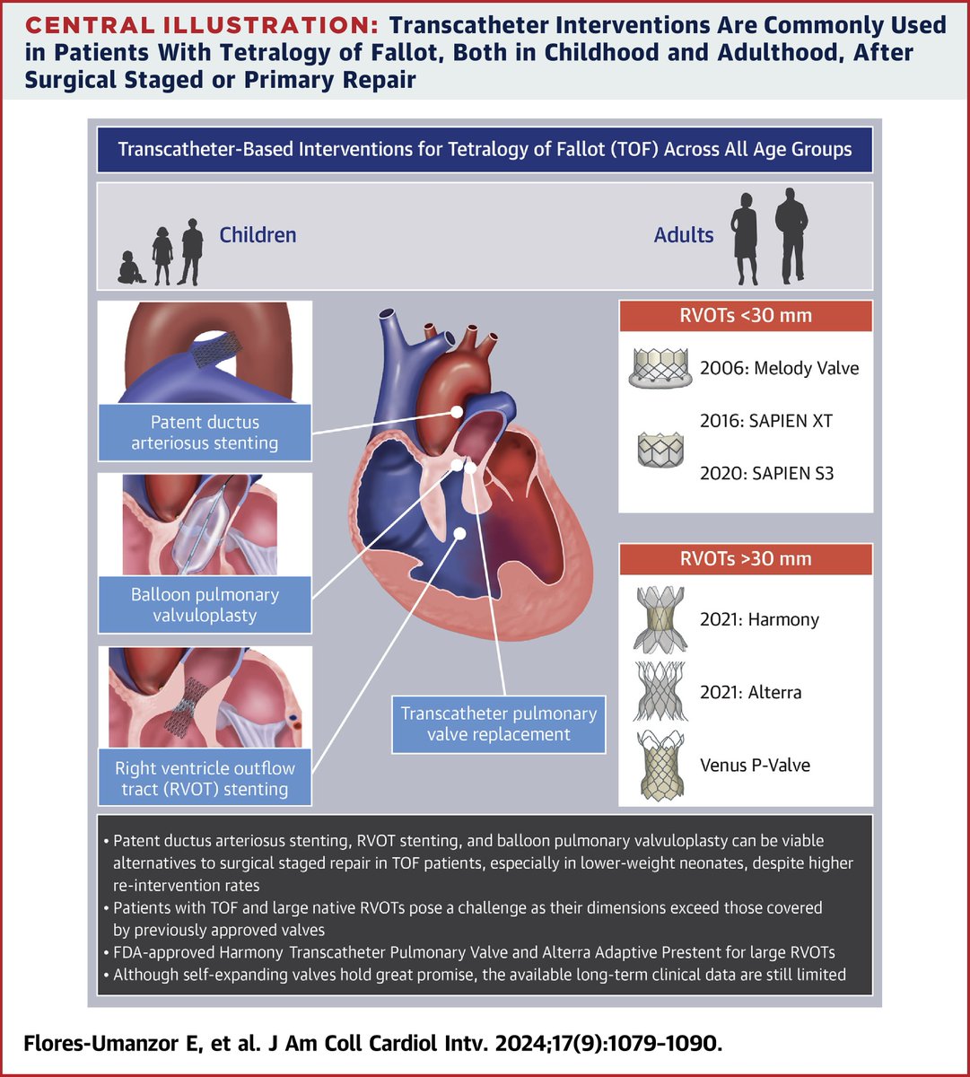 ACCinTouch's tweet photo. 🔑 Tetralogy of Fallot is the most common cyanotic CHD, occurring in 3–5 out of every 10,000 live births.

Read more key points from a state-of-the-art review on transcatheter-based interventions for TOF across all age groups in #JACCINT: https://t.co/InZNoKbmik https://t.co/xA2x875Zhf