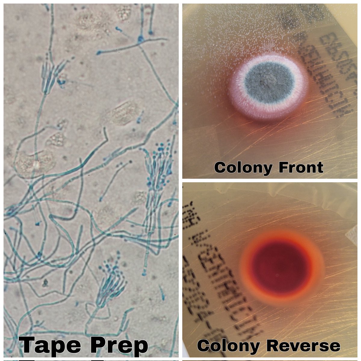 Julia Hankins, PhD, D(ABMM) tweet media