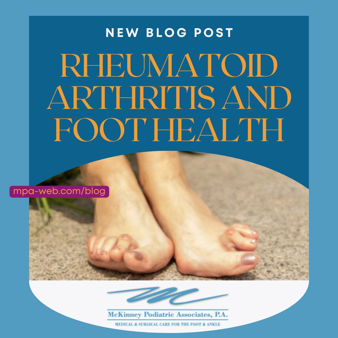 Don’t miss today’s blog post!
mpa-web.com/blog
.
.
.
#arthritis #rheumatoidarthritis #footarthritis #immunesystem #painrelief #arthritispain #bestpodiatrists #podiatrist #blog #medicalblog #podiatryblog #texaspodiatrist #podiatristintexas #McKinneyPodiatricAssociates