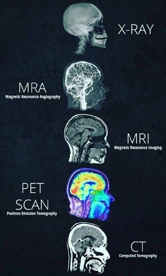 Some imaging modalities for the brain and cranium.