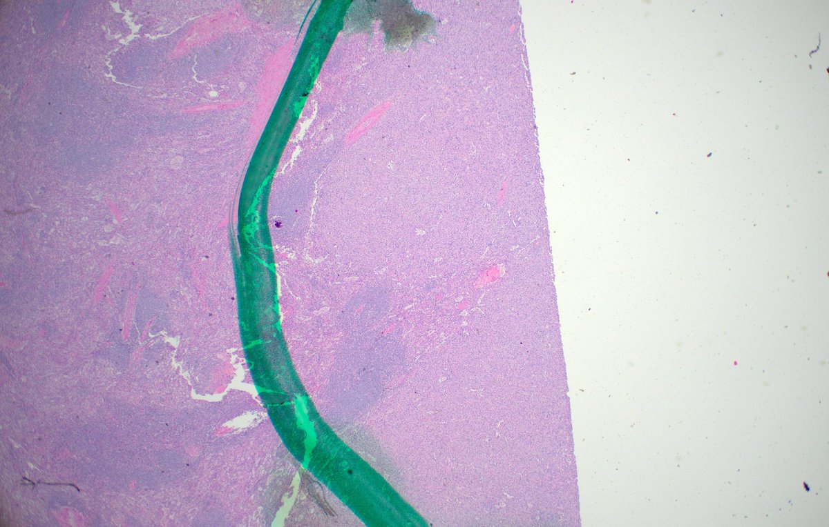 Brooj Abro, MD tweet media