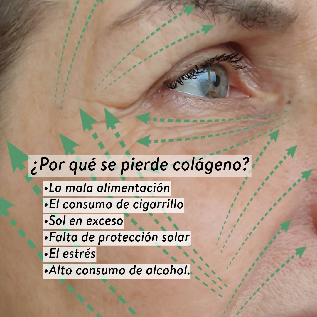 VivelightEc's tweet photo. Colágeno, fuente de juventud
alimentos que estimulan el colágeno.

• Concentrado de caldo de hueso; res, pescado
• Huevos
• Cítricos (frutas y verduras)
• Ajo 
• semillas, nueces, granos integrales, bananos aguacates. https://t.co/LokEOZuhop