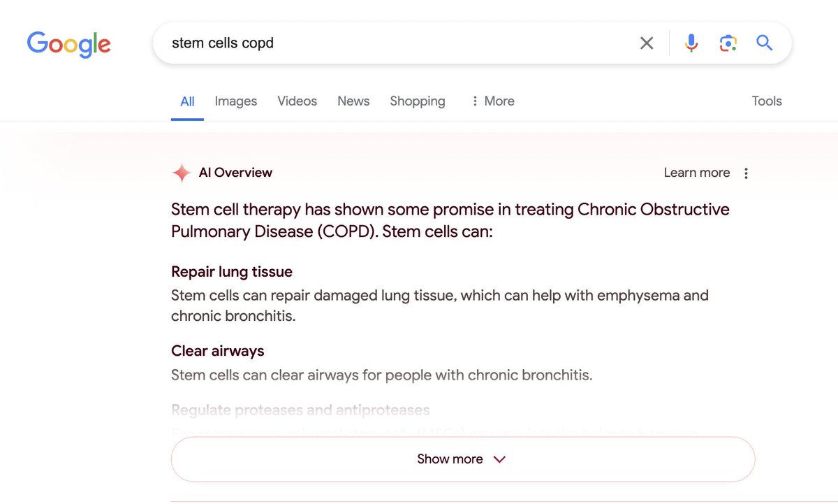 Oof. AI overviews in Google search have some problems. E.g. this AI overview is inaccurate & could do harm. The fact is that stem cells haven't been shown to do these things in the lungs. Some material seems sourced from an unproven clinic website that Google mysteriously loves