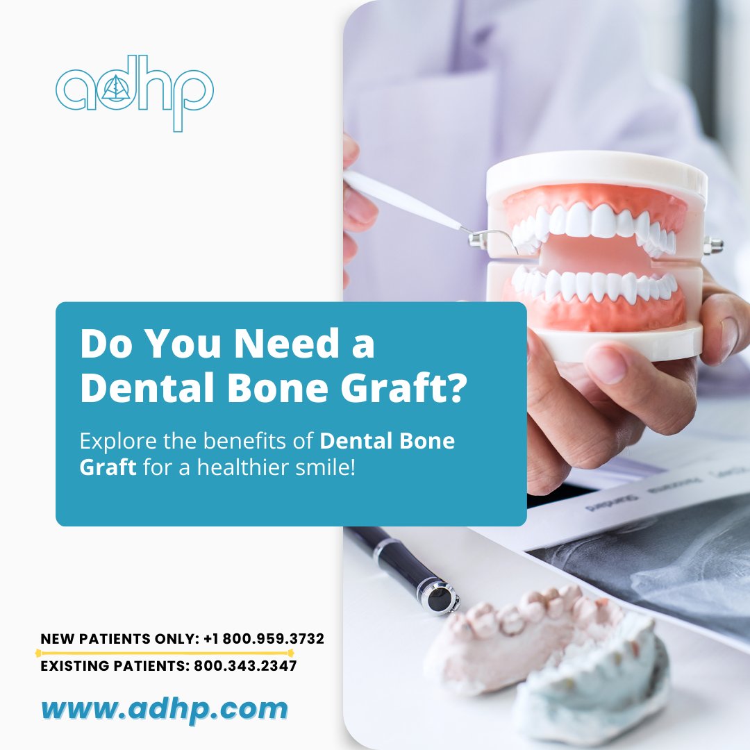teethimplantsdr's tweet image. Considering a dental bone graft? Strengthen your smile with dental bone graft and learn how it can improve your overall dental health. 🦷 
#ADHP #DentalCare #HealthySmile