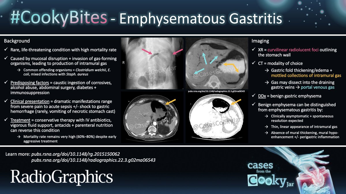 Answer: Emphysematous Gastritis

Learn more:
🔗pubs.rsna.org/doi/10.1148/rg…
🔗pubs.rsna.org/doi/10.1148/ra…

#CookyBites #164 #RGphx <a href="/cookyscan1/">Cooky Menias</a> <a href="/RadioGraphics/">RadioGraphics</a>