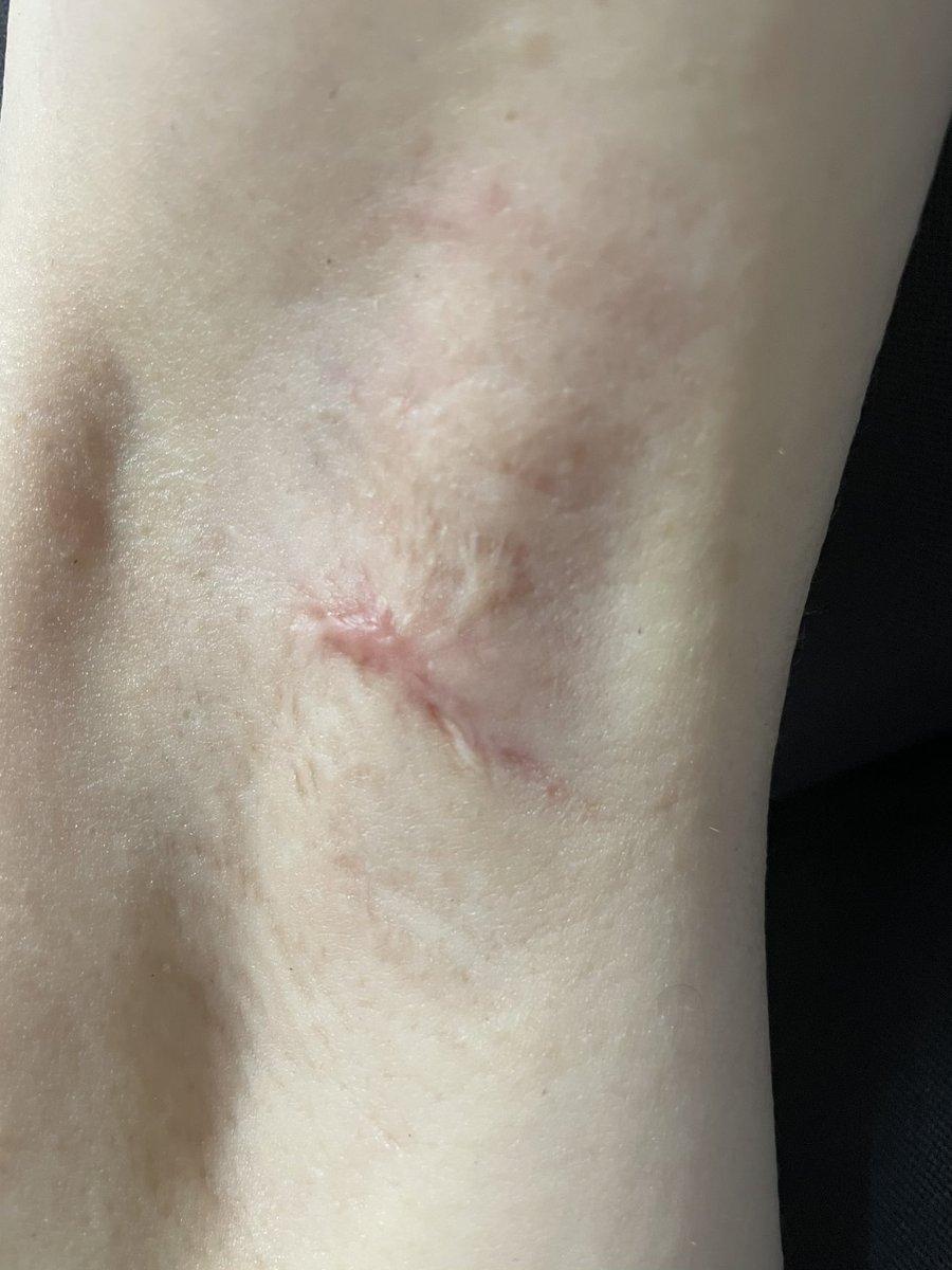 むくみちゃん tweet media