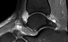 KenSheah's tweet photo. Vulture or eagle?
#msk #MRI https://t.co/6FzPLMg2OX