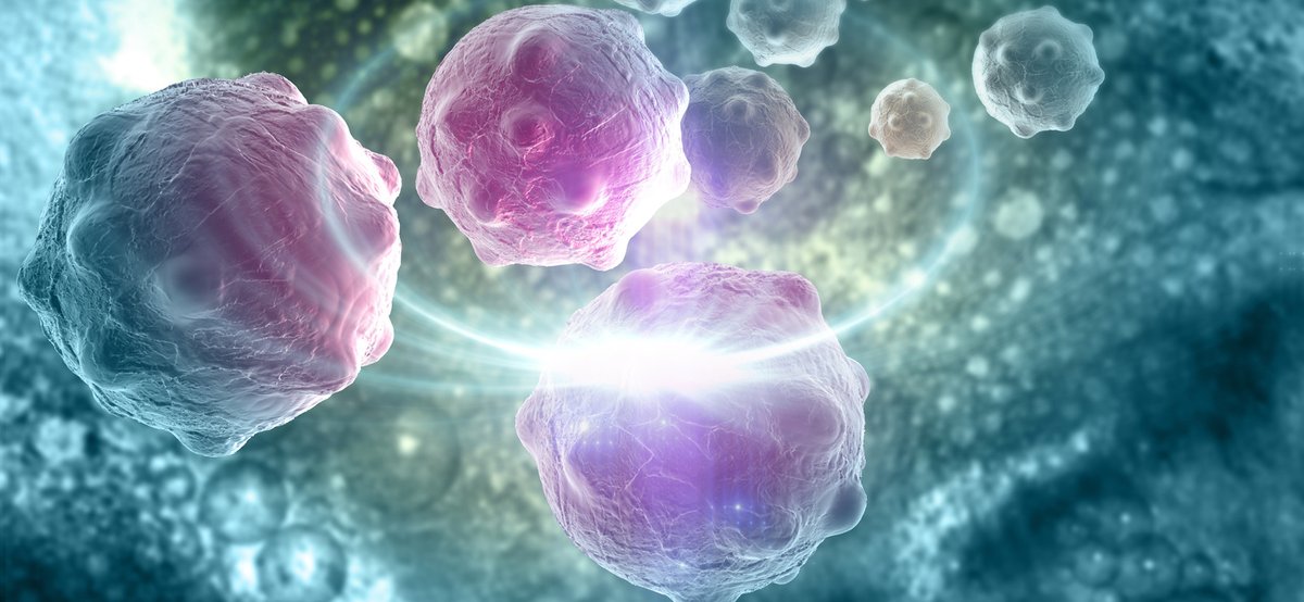 jimmunoallerg's tweet photo. Resident memory T cells are non-recirculating memory T cells that persist long-term in epithelial barrier tissues, including the gastrointestinal tract, lung, skin, and reproductive tract.
#residentTcells #reproductivetract #immunology #pathogens #tissues #peripheral #pathogens https://t.co/bFLGeqs7P1