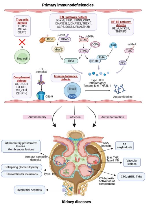 Now OA in @NDTsocial Primary immunodeficiency (PID) as a cause of immune-mediated kidney diseases 👉PIDs can cause autoimmunity 👉largely neglected in nephrology 👉many possibilities for research 👉PID as cause for infectious complications ▶️academic.oup.com/ndt/article/do…