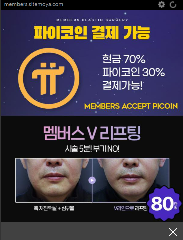 Koreanteacher1's tweet photo. Dr. Chun, the director of Members Plastic Surgery Clinic, actively promotes #Pi as a payment system and is dedicated to the Pi ecosystem. 

He was recently appointed as the president of the Catholic Medical Univerisy Alumni Association. 

During his inauguration, he enthusiastically installed the Pi app on the phones of other clinic directors. 

He believes that in the near future, numerous hospitals will be able to accept Pi  as a payment system. 

While it's uncertain if this will become a reality, I want to offer my support.

#PiNetwork #Pi #파이 #파이코인 #piecosystem #멤버스성형외과 #Membersplasticclinic