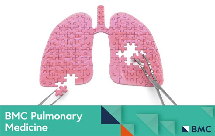 In #BMCPulmMed, researchers explore the factors associated with atrial fibrillation and heart failure hospitalisation within a month of COPD exacerbation. To learn more, visit: bmcpulmmed.biomedcentral.com/articles/10.11…