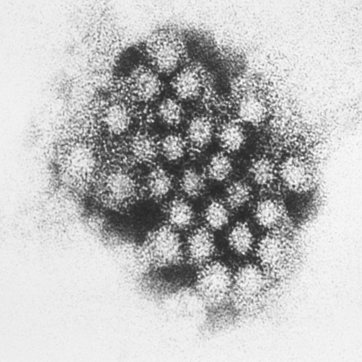 It's time for #MicrobeoftheMonth! Can you guess who I am? 1) I can survive on surfaces for weeks. 2) I cause 650 million infections worldwide every year. 3) Blood type may shape susceptibility to infection by me. Think you know? Comment below!