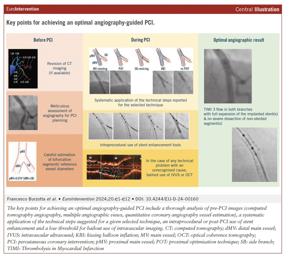 In the 18th Expert Consensus Document, now available in the Journal, the European Bifurcation Club (EBC) reviews and describes a series of tips and tricks which can help to optimize angiography-guided PCI for coronary bifurcation lesions. These include: - A thorough analysis