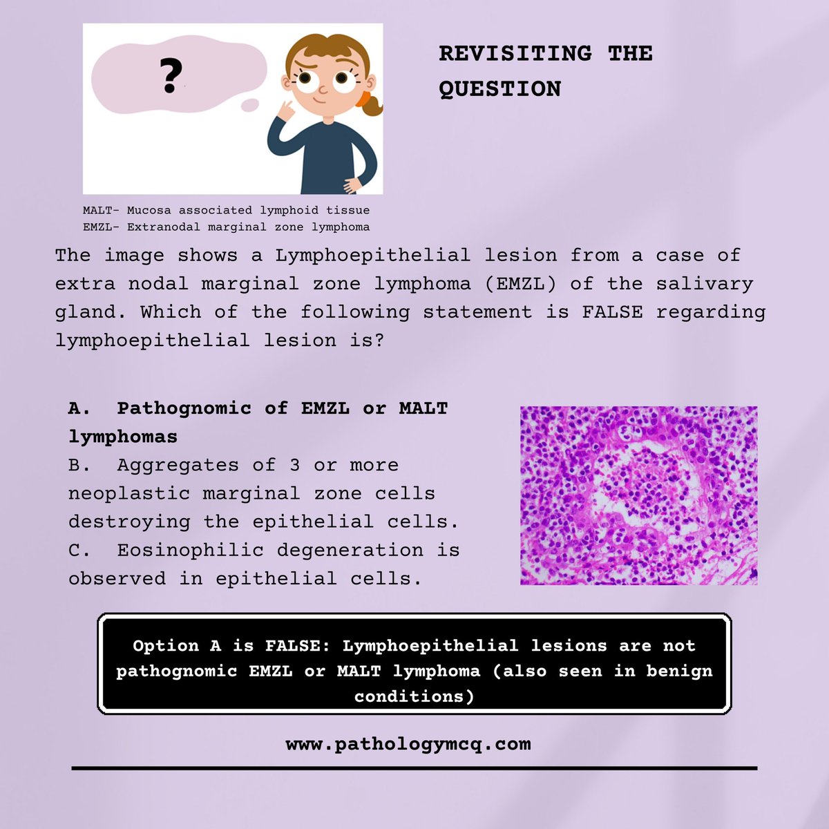 Question on lymphoepithelial lesion #pathologists #pathtwitter #pathology #pathboards #frcpath