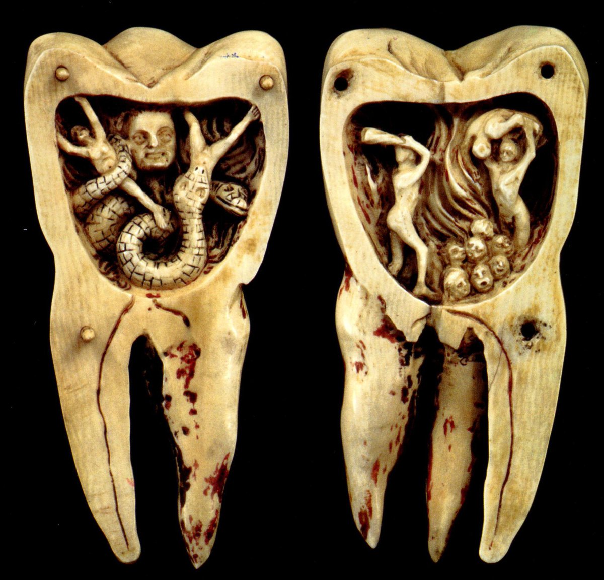 'The Tooth Worm as Hell's Demon,” 18th century. Carved from ivory, the two halves open up to reveal a scene about the infernal torments of a tooth worms which people believed caused cavities in the past. Complete with mini skulls, hellfire, and naked people wielding clubs.