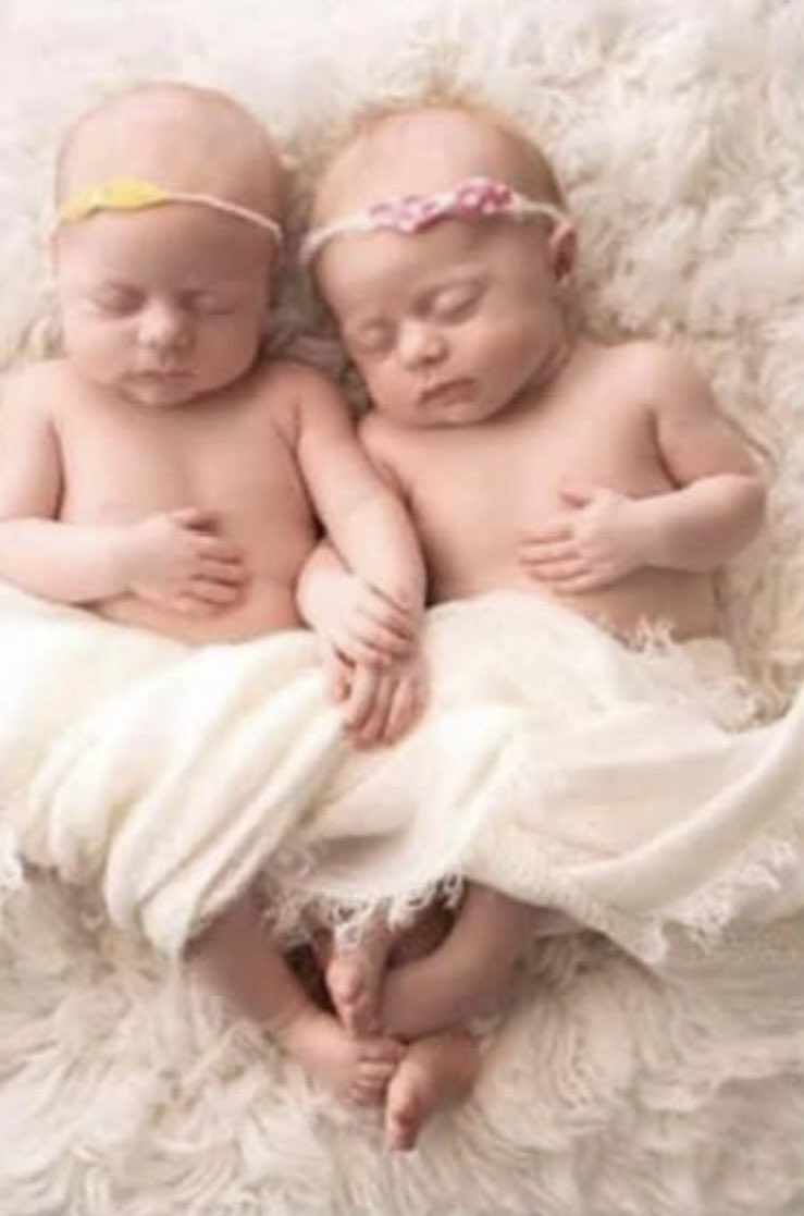 What do you think? Can there be such a thing as 'Simultaneous Sudden Infant Death'? Twin girls. 3.5 months old. No medical history. Completely healthy. Received five 'baby wellness Shots” Injected with chemical concoctions in the hope of protection against: Polio, Diphtheria,