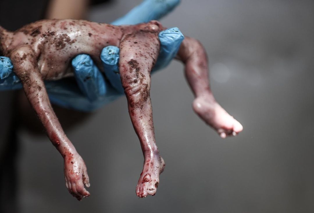 Gazze'de soykırım devam ediyor lütfen acımıza alışmayın