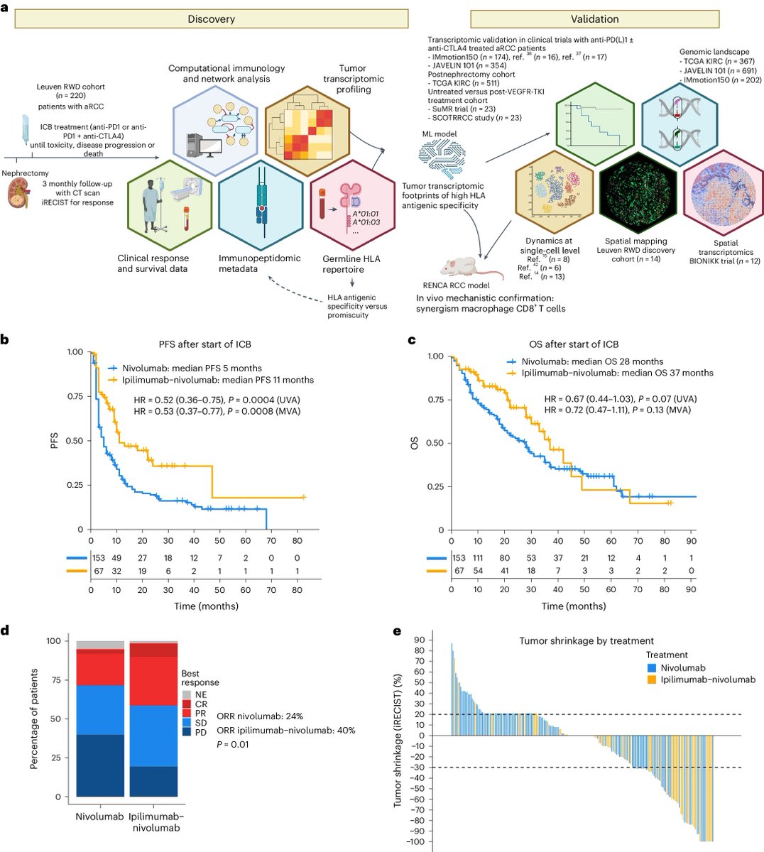 Spatial HLA signature may predicts response to immunotherapy in advanced renal cell carcinoma. @NatureMedicine @OncoAlert #CancerResearch #oncology #kidney nature.com/articles/s4159…