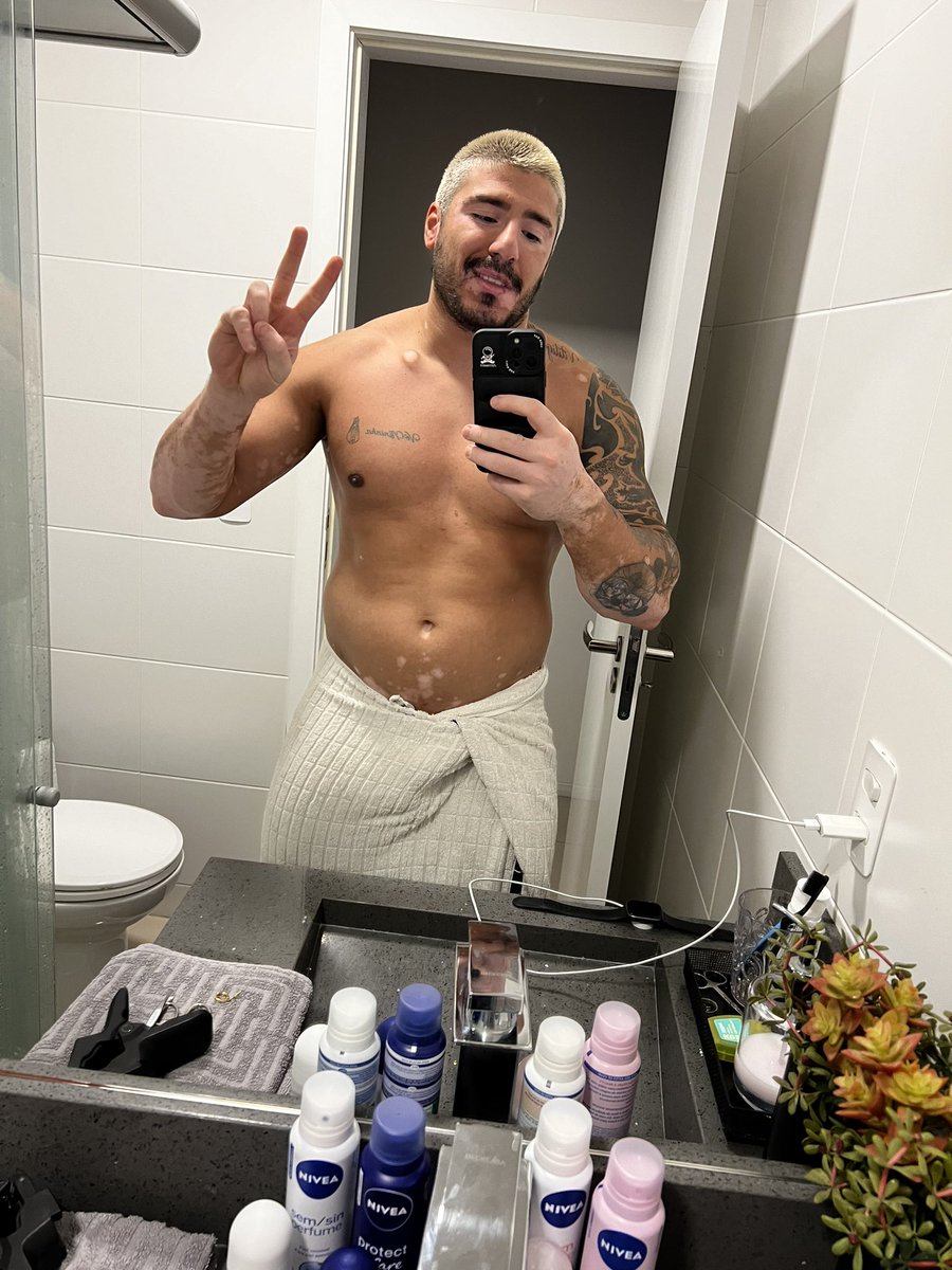 Diego Kydo 🐼 #vitiligo tweet media