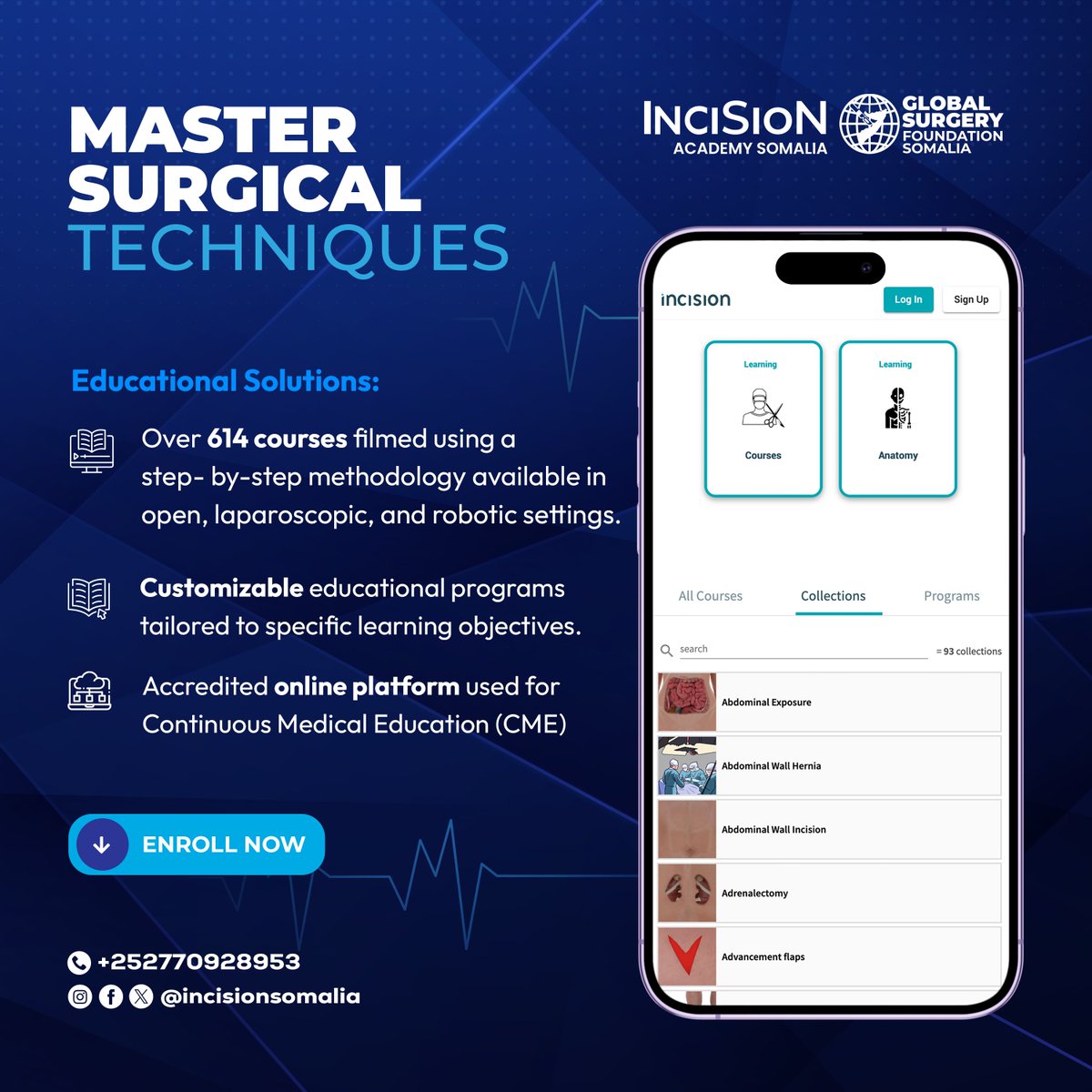 💉 Transform Your Surgical Skills Today!

Join the revolution in surgical education with Incision Somalia. Over 614 courses designed to enhance your expertise. 📞 Call us now at +252770928953 to enroll and elevate your surgical career.

#incisionAcademy #InciSionSomalia