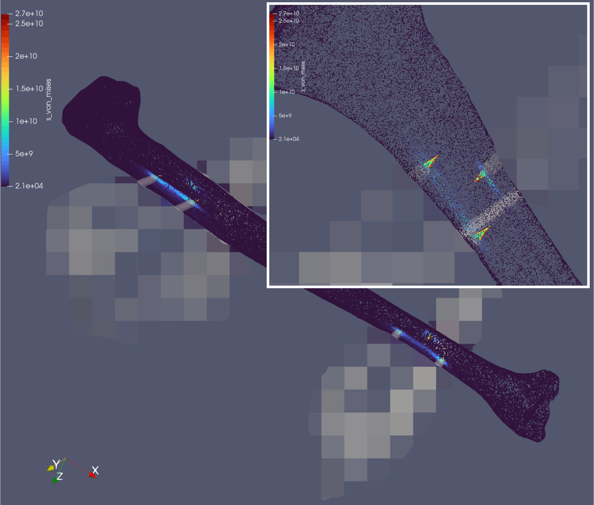Our team has been working closely with a biomedical engineering company to help them build complex neural physics simulators that aid their rapid prototyping process in building novel Tibia bone fixator that uses clamping system. They've leveraged physics-informed neural