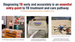 BorneWater's tweet photo. Home screening key to tracking TB cases early... 
Submit your paper at: https://t.co/VHeEmWy2kG
Read more: https://t.co/IsWTj4mjb5 #awbd #Cholera #PathologySanitary #Engineering #Taeniasis #Tuberculosis #Vaccinology 
#manuscript 
#Researchpaper 
#Japan https://t.co/lUbVf8RYGl