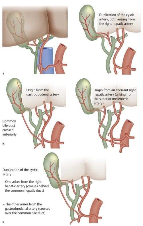 Duplication of the cystic artery! Have a look👇 #MedX #MedEd #Surgery