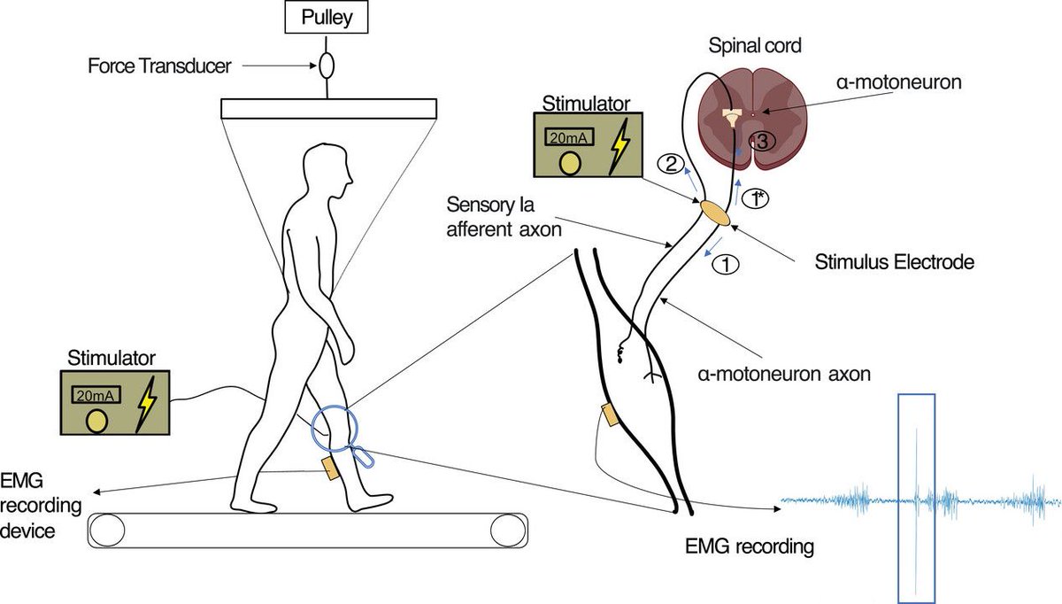 Experimental Physiology (@expphysiol) on Twitter photo Yong Kuk Kim, Michelle Gwerder, <a href="/w_r_taylor/">Bill Taylor</a>, Navrag B. Singh (<a href="/lmbethz/">Laboratory for Movement Biomechanics, ETH Zürich</a>) and Heiner Baur (<a href="/bfh_hesb/">Berner Fachhochschule</a>) assess the adaptive gait responses to varying weight-bearing conditions!
📜buff.ly/3UAGVWm Yong Kuk Kim, Michelle Gwerder, <a href="/w_r_taylor/">Bill Taylor</a>, Navrag B. Singh (<a href="/lmbethz/">Laboratory for Movement Biomechanics, ETH Zürich</a>) and Heiner Baur (<a href="/bfh_hesb/">Berner Fachhochschule</a>) assess the adaptive gait responses to varying weight-bearing conditions!
📜buff.ly/3UAGVWm