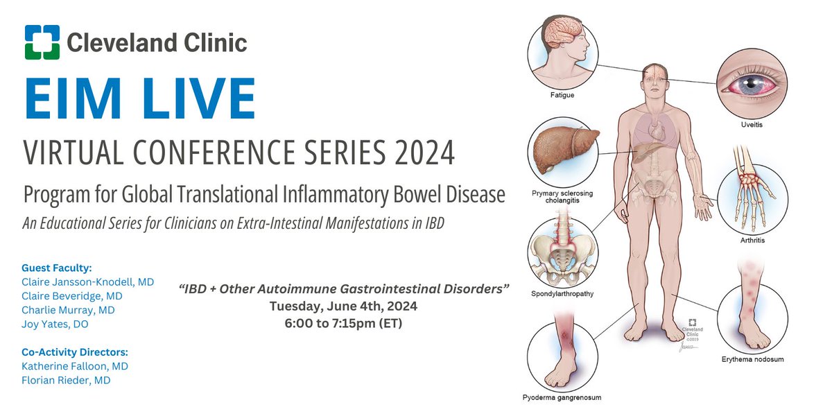 Carrie Bristor (@bristorcarrie) on Twitter photo Please join us for our next EIM LIVE on Tuesday, June 4th @ 6:00pm (ET) w/ Drs. <a href="/KatieFalloonMD/">Katie Falloon</a>, <a href="/IBD_FloMD/">Florian Rieder</a>, <a href="/JoyYatesDO/">Joy Yates, DO</a>, <a href="/BeveridgeCA/">Claire Beveridge, MD</a>, <a href="/CharlieMuz/">Charlie Murray</a>, and Claire Jansson-Knodell
Â
Topic: IBD + Other Autoimmune Gastrointestinal Disorders
Â
Register: bit.ly/EIMLIVE2024 Please join us for our next EIM LIVE on Tuesday, June 4th @ 6:00pm (ET) w/ Drs. <a href="/KatieFalloonMD/">Katie Falloon</a>, <a href="/IBD_FloMD/">Florian Rieder</a>, <a href="/JoyYatesDO/">Joy Yates, DO</a>, <a href="/BeveridgeCA/">Claire Beveridge, MD</a>, <a href="/CharlieMuz/">Charlie Murray</a>, and Claire Jansson-Knodell
Â
Topic: IBD + Other Autoimmune Gastrointestinal Disorders
Â
Register: bit.ly/EIMLIVE2024