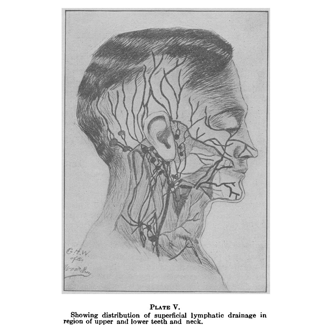 From the NEJM Archive: A Functional Relation of the Tonsil to the Teeth (Original Article, May 20, 1909) nej.md/3UKRHcP