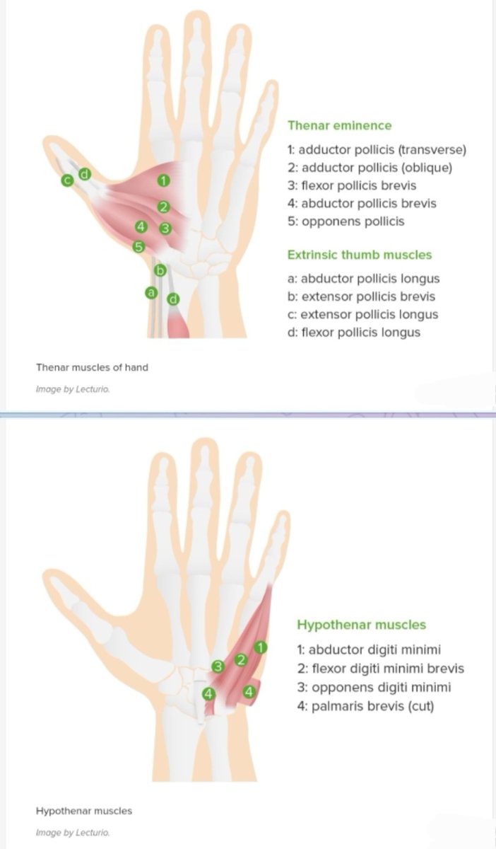 Hand Muscles divided into 2 groups based on Muscle belly location: ●Extrinsic: M bellies are in forearm. ●Intrinsic: M bellies are within hand: -Thenar (All innervated by median n.(except for adductor pollicis) -Hypothenar :ALL innervated by Ulnar n -Interossei -Lumbricals
