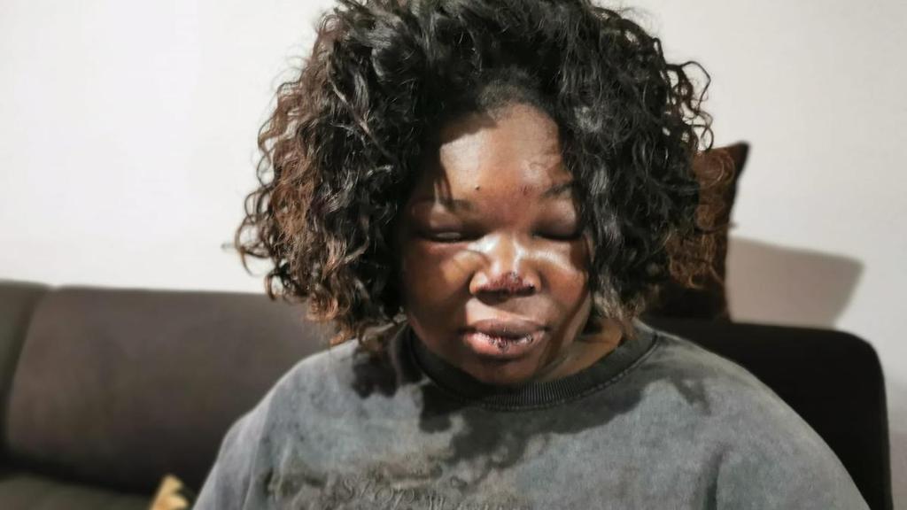 Eu fui dos primeiros a ver Cláudia Simões depois de chegar a casa vinda do hospital. O rosto estava cheio de hematomas. Nenhuma detenção, dentro das normas legais, provoca aquele tipo de lesões.